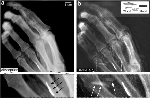 Simultaneous wood and metal particle detection on dark-field radiography